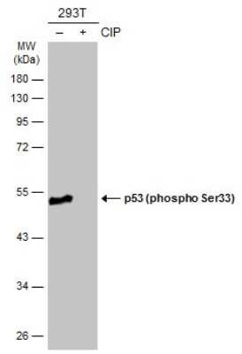 Western Blot: p53 [p Ser33] Antibody [NBP3-13309]
